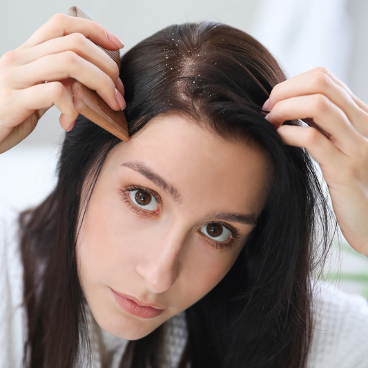 Dry Scalp or Dandruff? Learn How to Treat Both Effectively